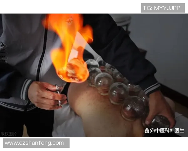 足球明星亲身体验拔火罐疗法揭秘运动员的养生之道与健康秘密